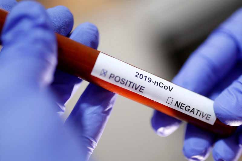 Aktualisiert: Ab heute gelten in Montenegro neue Quarantänemaßnahmen
