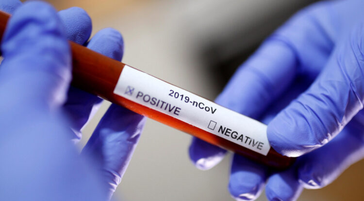 Die Zahl der Coronavirus-Infizierten in Montenegro – mehr als 1500 Personen